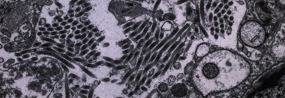 ebola disease detectives answer key