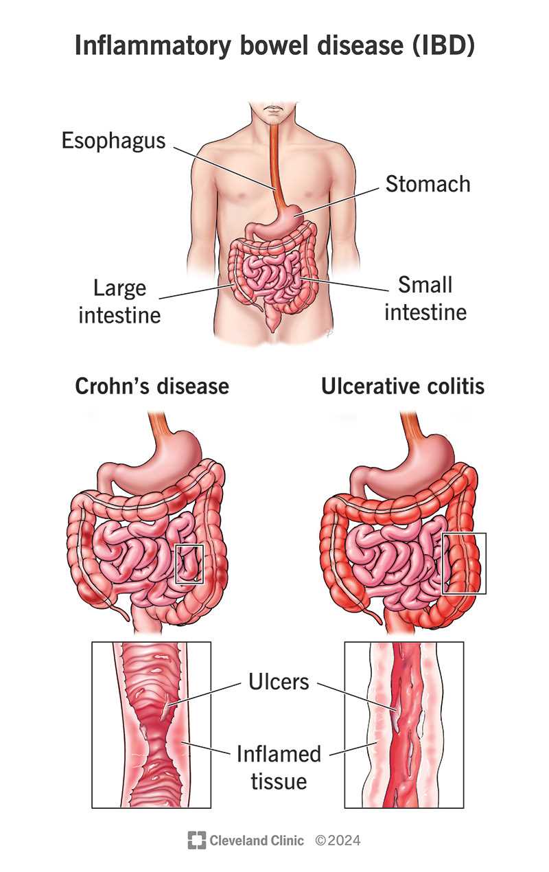 essentials of human diseases and conditions answer key