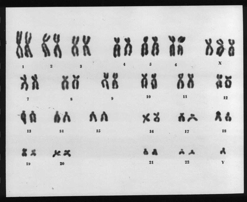 making karyotypes answer key
