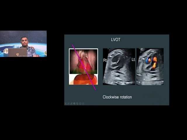 ncert fetal cardiac sonography review answer key