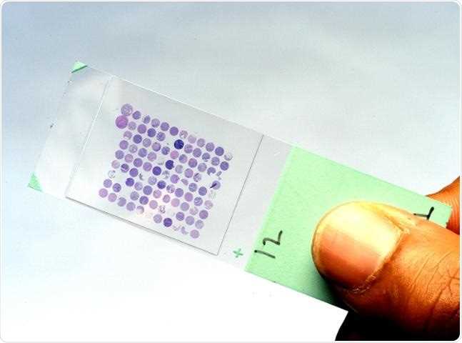 dna microarray virtual lab answer key