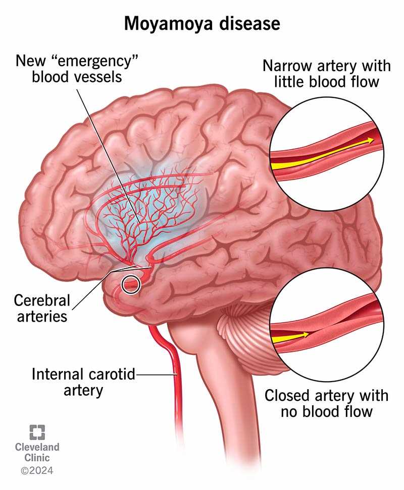 essentials of human diseases and conditions answer key