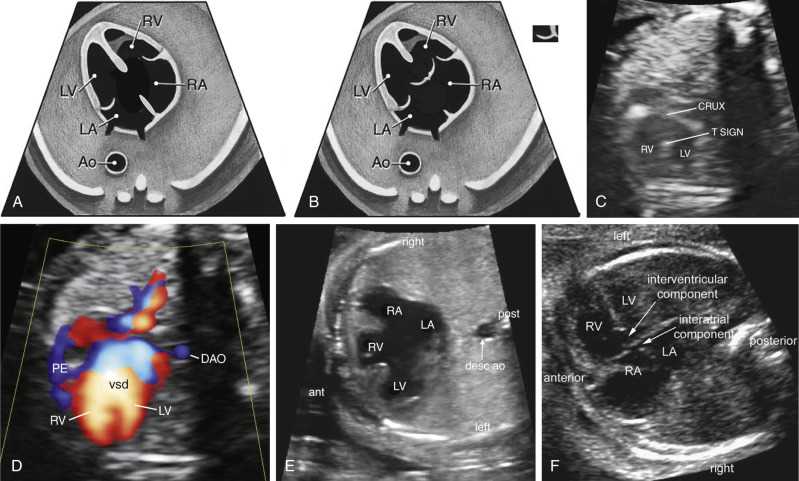 ncert fetal cardiac sonography review answer key